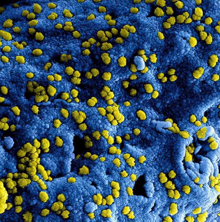 Coronavirus